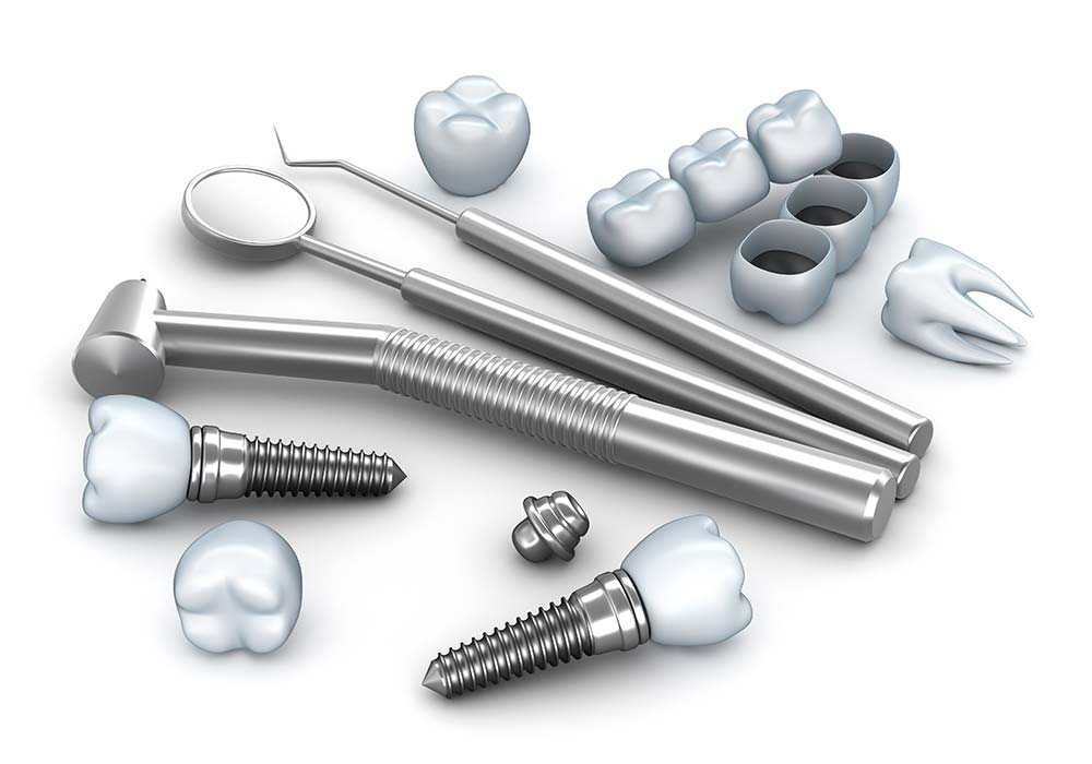 入れ歯やブリッジにお悩みの方へ、インプラントという選択肢